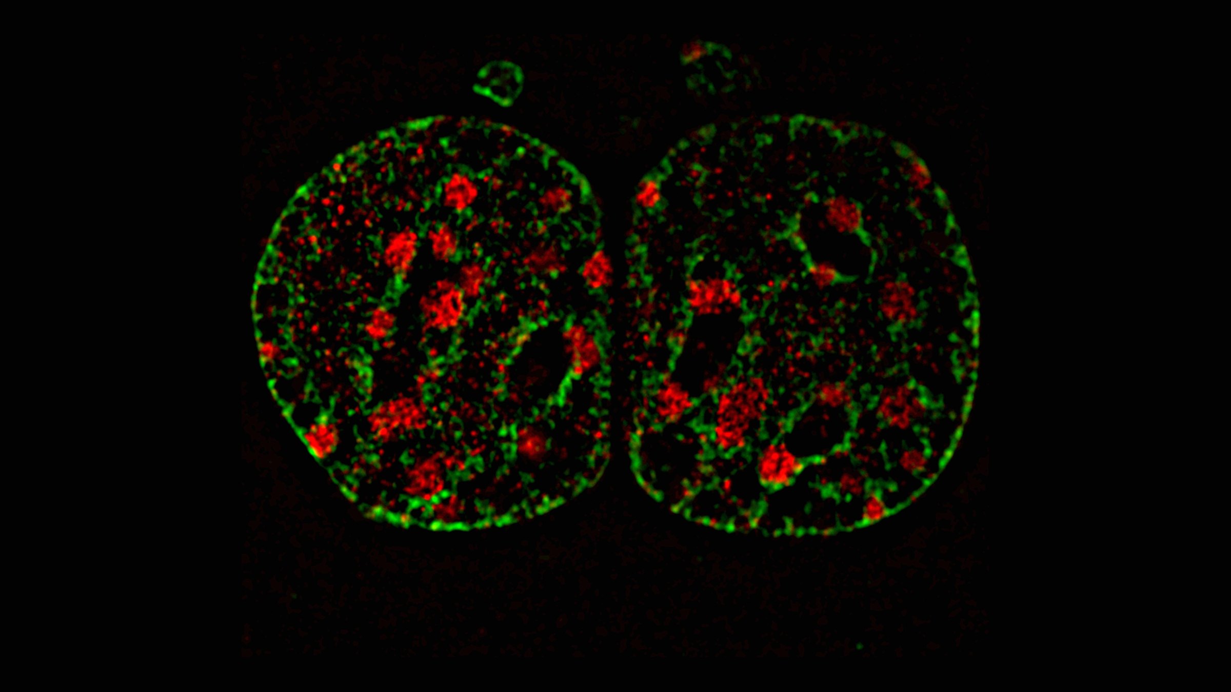 Two human cell nuclei side by side, caught just as one cell became two