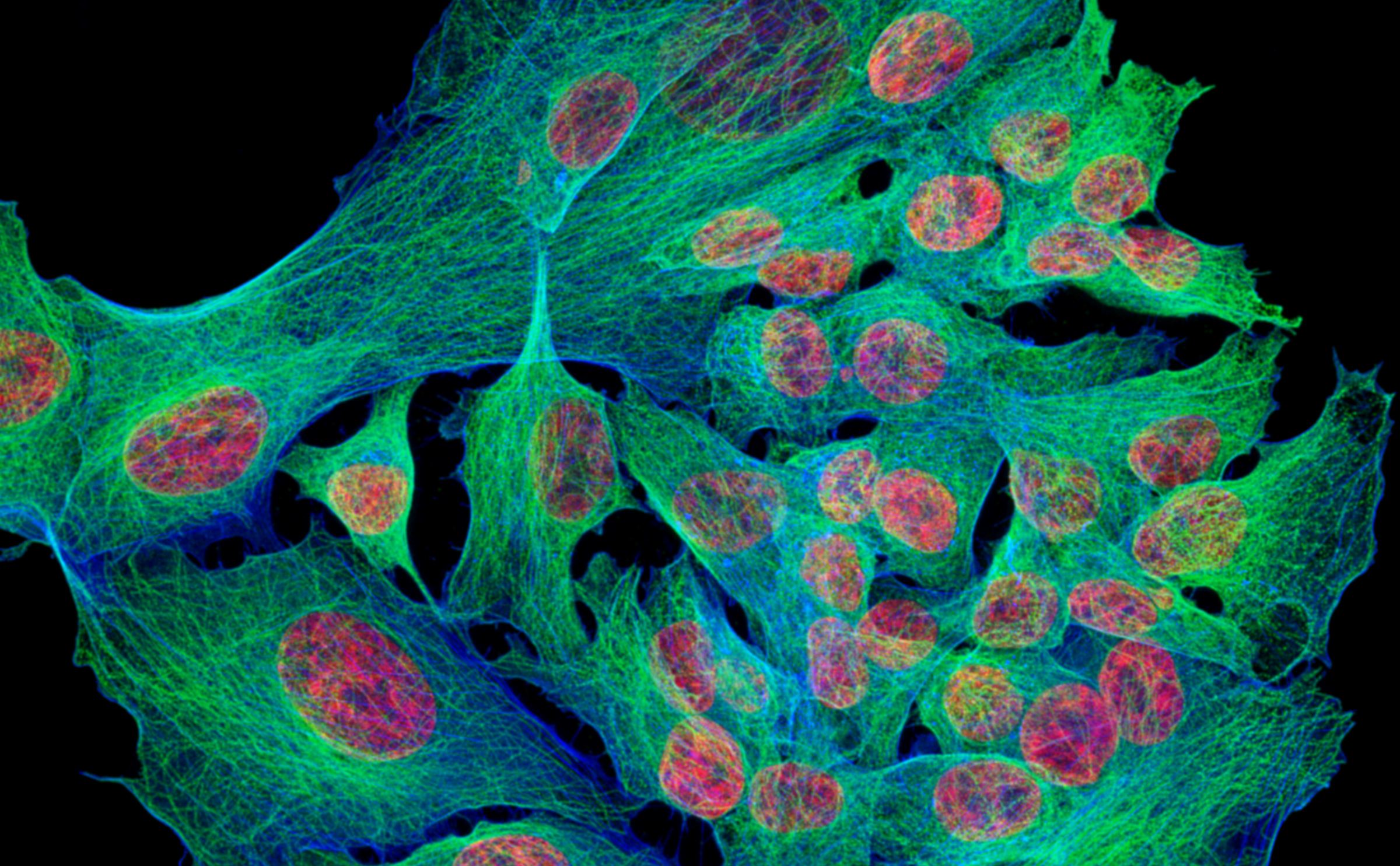 Human bone-cancer cells under a fluorescence microscope, their internal scaffolding in green and blue and their nuclei in red